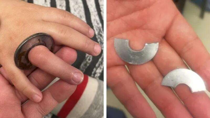 Спасатели МЧС помогли малышу вынуть палец